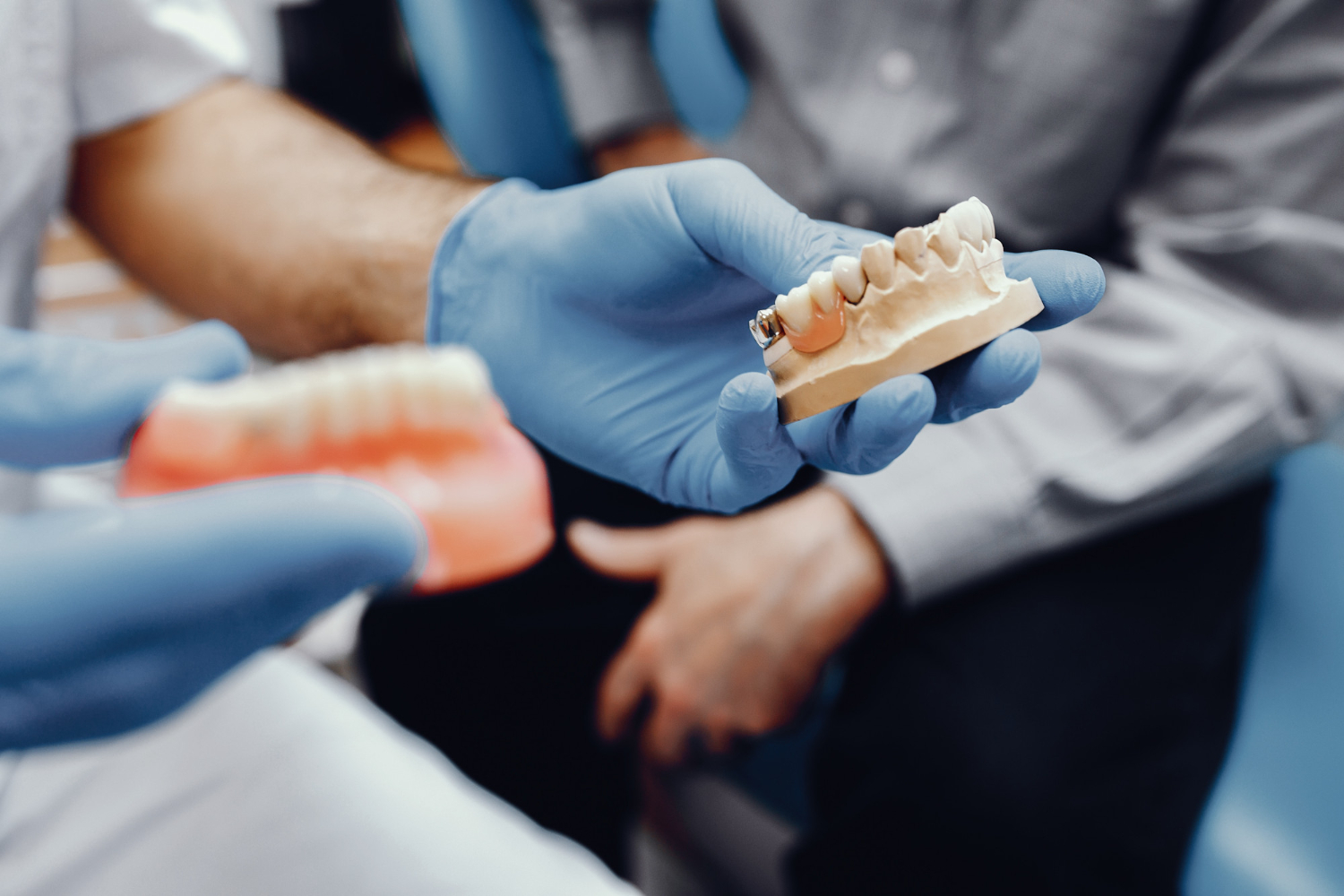 Zahnimplantate in der Türkei Kosten, Qualität und Erfahrungen